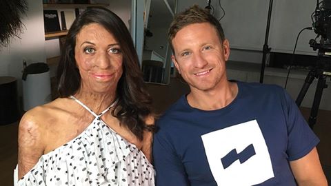 Vor 6 Jahren bei einem Ultramarathon fast verbrennt - nun ist Turia Pitt schwanger!